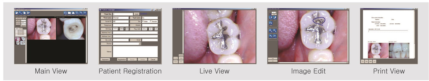Whicam Story 3 Intraoral Camera – Wireless