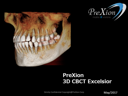 PreXion 3D Excelsior