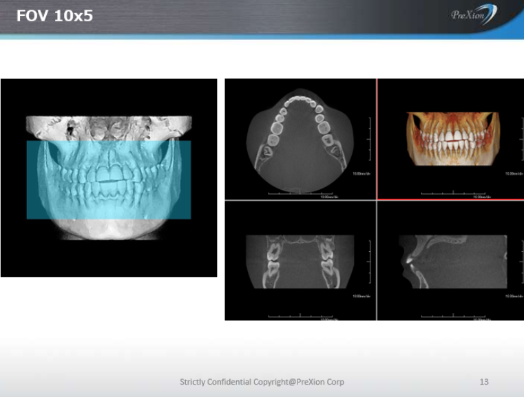 PreXion 3D Excelsior